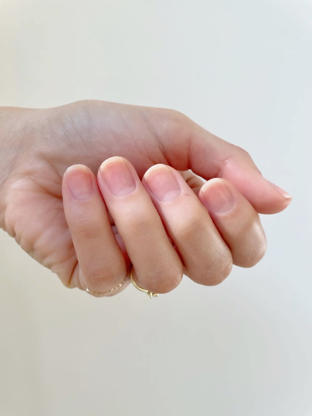 a hand with folded with no nail polish