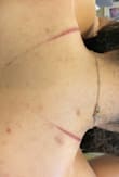 Honestly I loved this dress on me but it left a horrible scar that looks like a burn mark on my back. I'm very disappointed and do not recommend this dress. - Theresa Q.