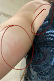 I never leave reviews but this needs one. Bought this dress to wear to a friend's wedding and it ****** up my arm. Had to leave early because I couldn't take the scratching on the side of my arm. I'll attach a picture of what it did. Went to the bathroom at the reception to take a picture to document. If I could return it I would, I know I won't be wearing this ever again. If you want a dress that will f up your arm this is it. Very disappointed - Dreily S.
