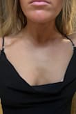 Both the dress straps BROKE after 1 hour...I was at a wedding and was being held together with safety pins. It was so embarrassing. I requested a refund and was told they could only give me a partial one or store credit. Extremely disappointed in this dress and my experience with LuLu's. - Summer C.