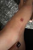 The sandals rubbed the entire side of my foot, causing several blisters. I can't wear them anymore. - Jucara E.