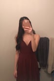 It looks exactly like the photo!! The quality is great and I'm going to be wearing it for prom! Everything fit perfectly except for the length. It was a bit too long because I'm 5'2" but everything else fit perfectly. (SIZE: XS) - Rachel T.