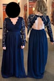 At 5'2", I expect needing to hem, but for reference, I am not wearing shoes in try-on photo. I ordered 4 size S dresses to try and this one was the biggest and least flattering. I think it looked matronly. Could an XS have helped this? Perhaps, but I'm happy enough with the others, exchange isn't necessary. - Dana U.
