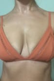I love the color of this bikini top and the sexy peek a boo eyelet details. Runs only slightly small but fits my slender and petite frame perfectly snug! I over spill an A cup but don't totally fill a B cup. The top fits perfectly snug around the rib band and I definitely have plenty of cleavage overspill in the cups. Not too much to need to order up a size though. However ladies, there is absolutely no lining to conceal any "headlights" nor any kind of support in the cups or band. I would love it more if the shoulder straps and rib band were 1/8" to 1/4" wider for more stability and support and if it had a nipple liners just in the triangular front panel for privacy. Otherwise it's well made and high quality fabric. Love this top! - Monika J.