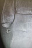 The first time I wore them I fell down I fell down and broke my ankle other than that they're pretty - Shawn H.