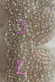 I love Lulus, and ordered a couple of times. I ordered XS and XXS for this dress. The dress looks beautiful. However, both items have quality issues. The XXS one seems to have been kept in the warehouse for a long time, because some plastic pearl is not shiny (compared to the XS one), and it has mold on seam (see pic 1) Also, the rhinestone has a rust-like thing on top of them. The dress doesn't look new. The XS one has a spot [with] missing rhinestones at the front. Apparently, they forgot to sew a line of rhinestones. - Jeff X.