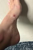 The sandals rubbed the entire side of my foot, causing several blisters. I can't wear them anymore. - Jucara E.