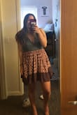 I've been eyeing this dress for a while and finally bought it!! Super super cute, all my roommates were very jealous of it, already asking to borrow it! The upper part is a tiny bit baggy but I also have a small bust, but all in all super cute, especially the back! - Sascha E.